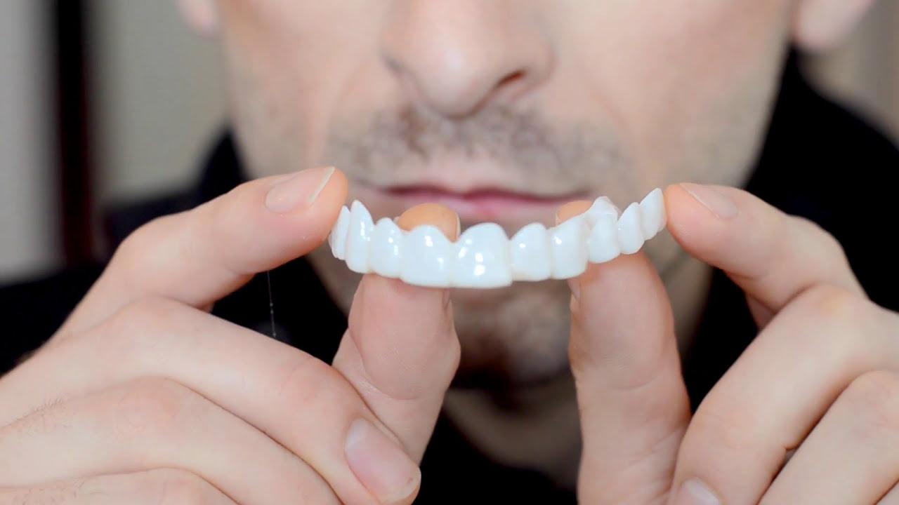 Partial Dentures