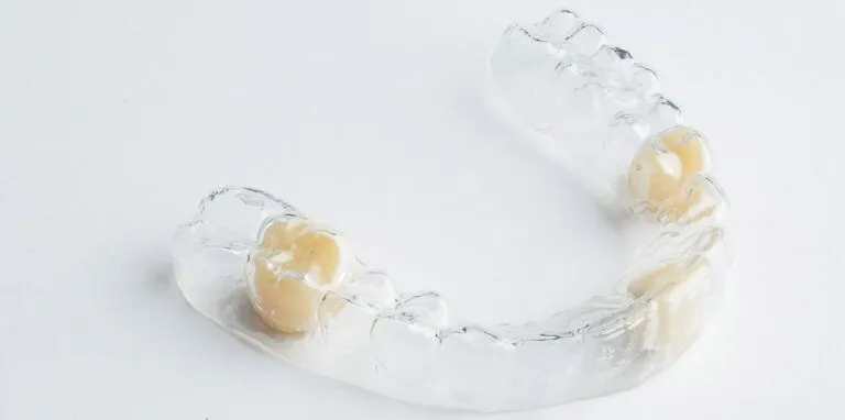 Essix Partial Denture Retainer: Pros, Cons, and Cost