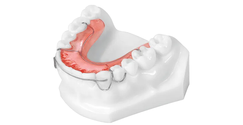 What is a Hawley Retainer