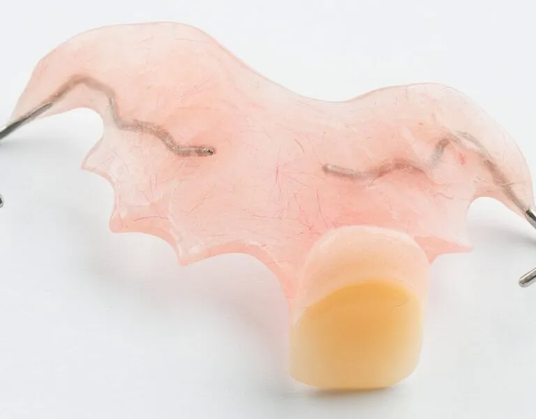 Smile with Confidence : The All-Acrylic Partial Denture Flipper
