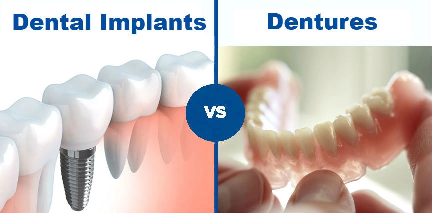 Partial Dentures vs. Dental Implants: Choosing the Right Option
