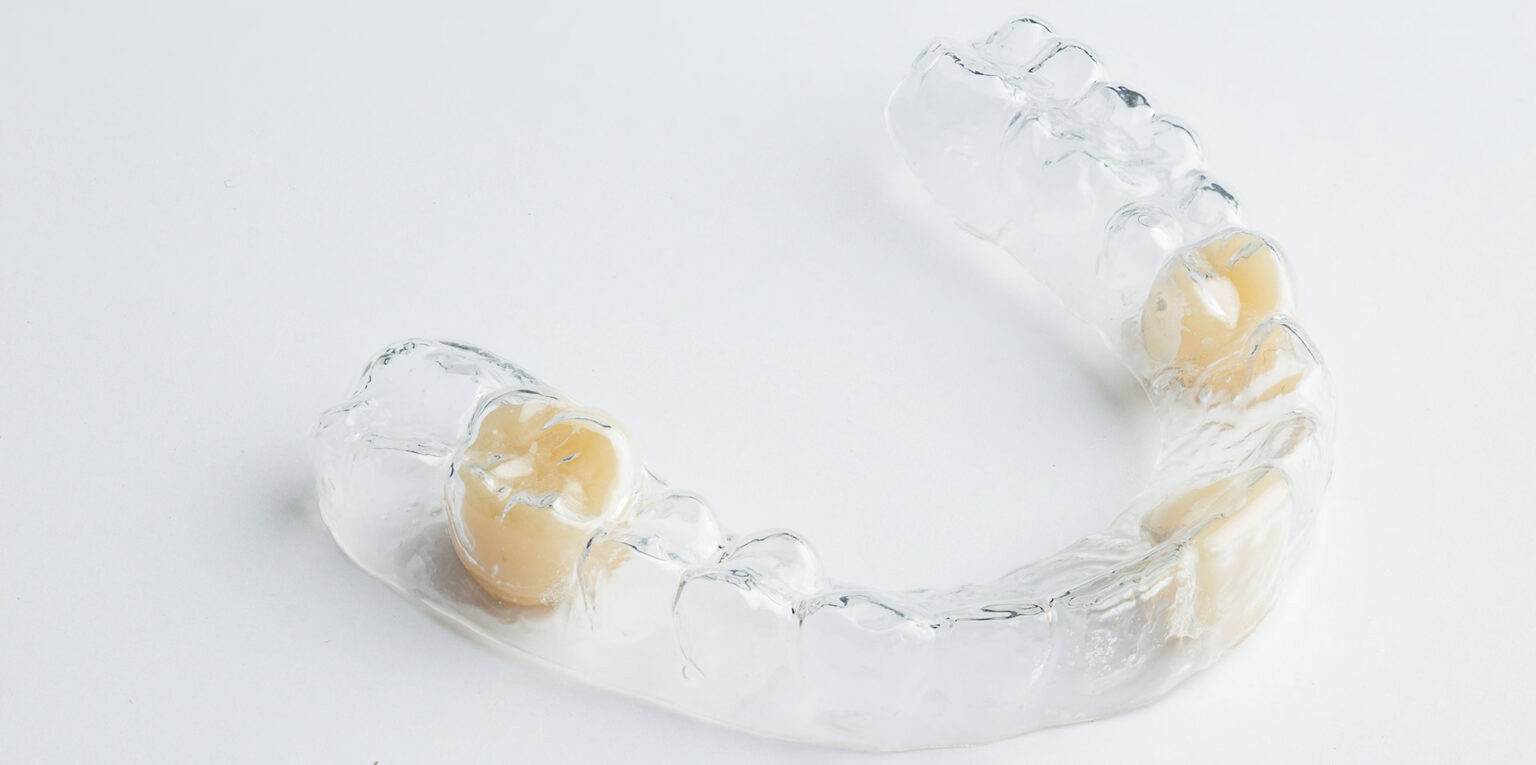 Essix Partial Dentures: The Invisible Solution for Missing Teeth