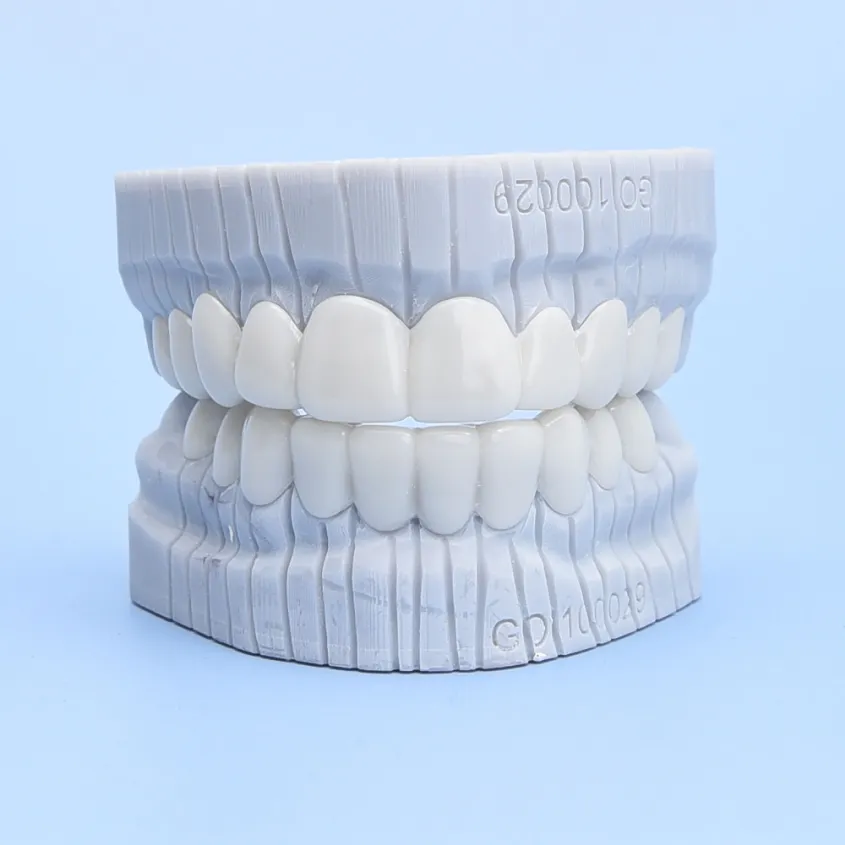 Are Snap-On Veneers Right for You?