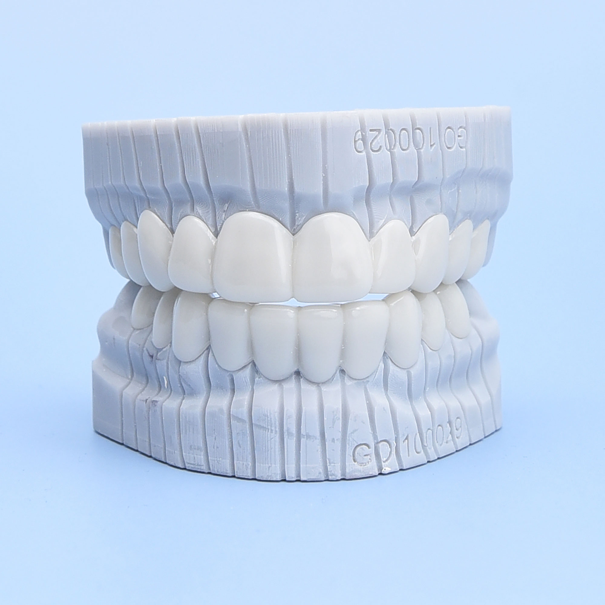 Vida Veneers Custom-Made Snap-On Veneers