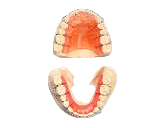 Hawley Orthodontic Retainer