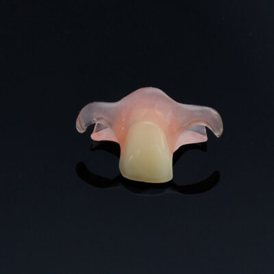 Nesbit Flexible Partial Denture