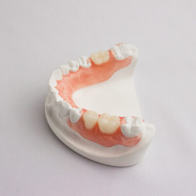 Flexible Partial Dentures