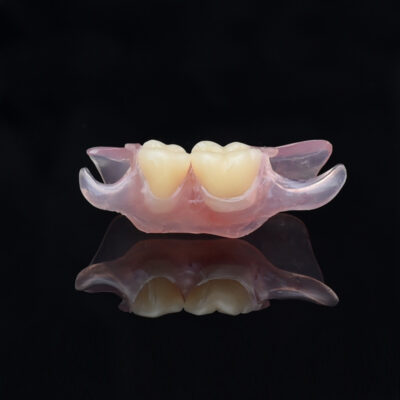Nesbit Flexible Partial Denture