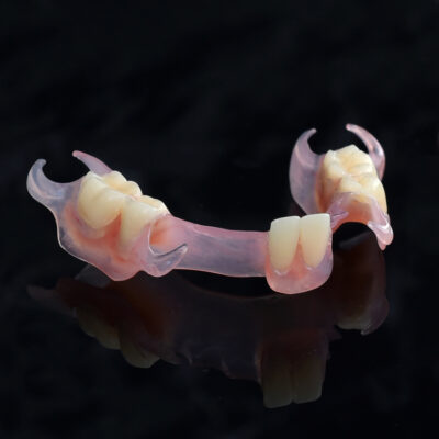 Flexible Partial Dentures
