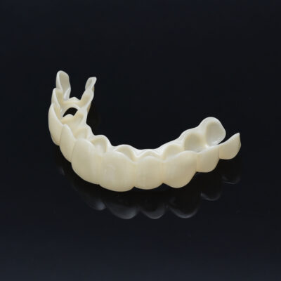 Vida Veneers Custom-Made Snap-On Veneers