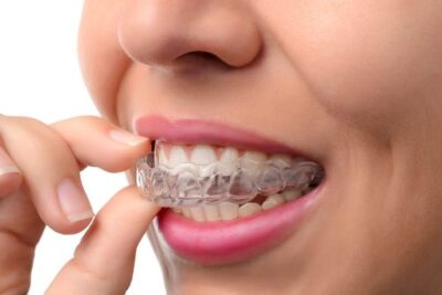 Clear orthodontic retainers