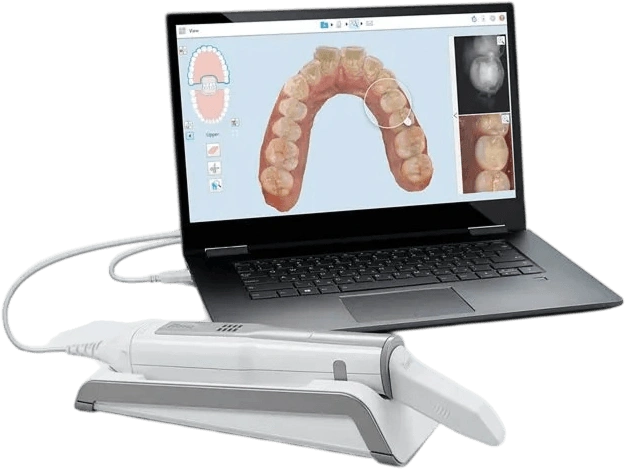 Impression Kit