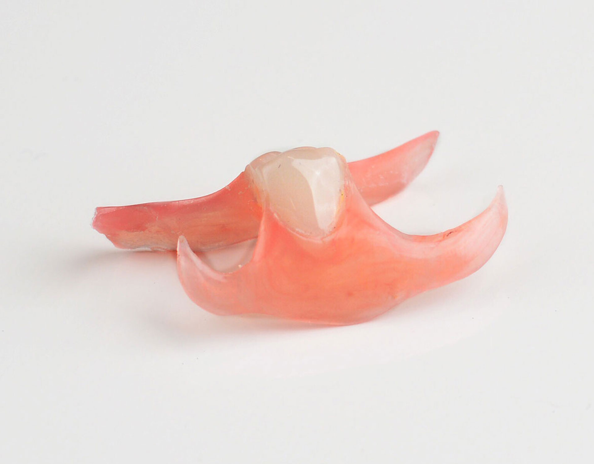 The Advantages of Nesbit Flexible Partial Dentures